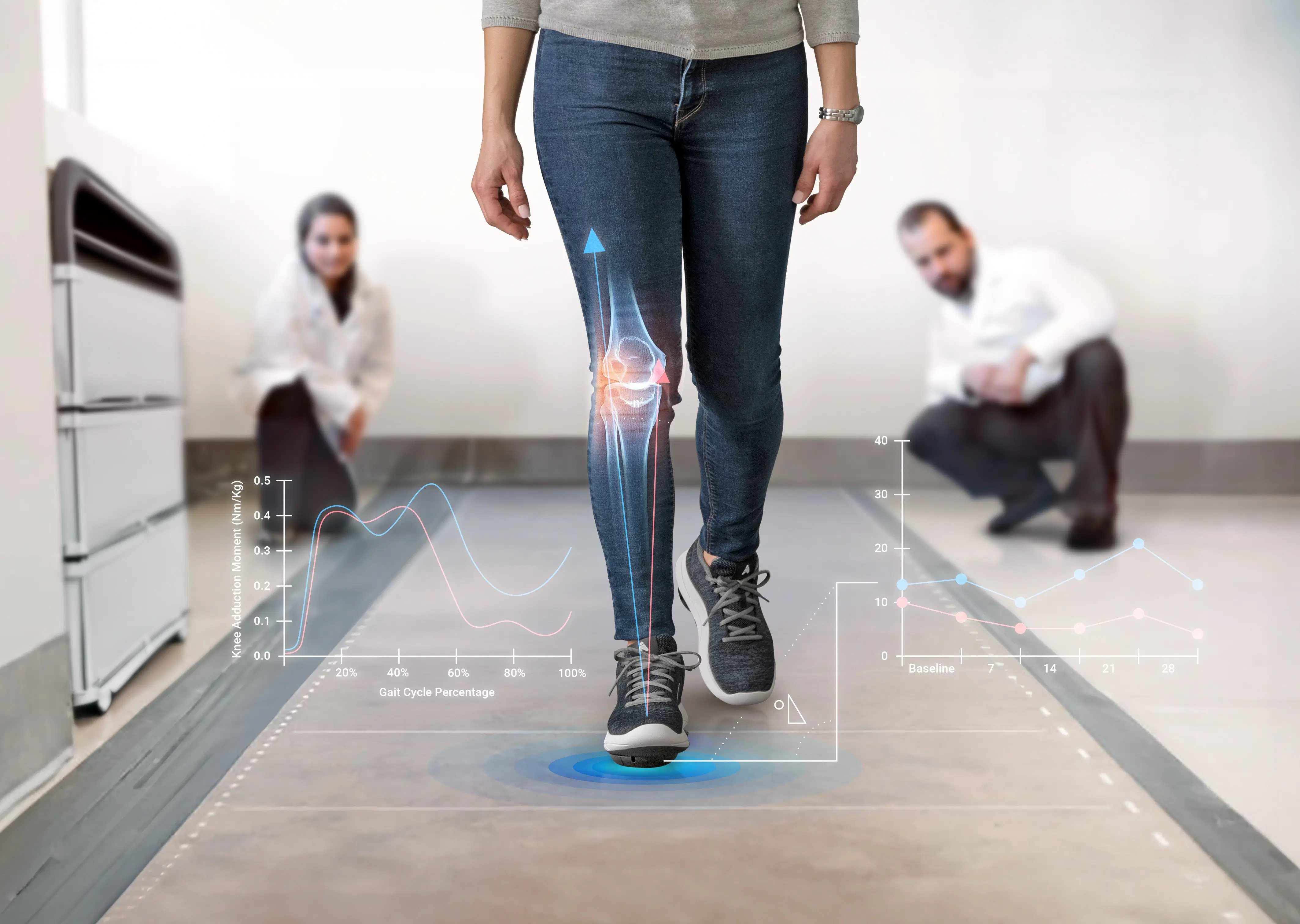 Patient walking across a pressure-sensing mat during Apos® gait analysis