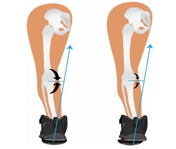 How Apos® pod positioning changes the forces acting on the knee